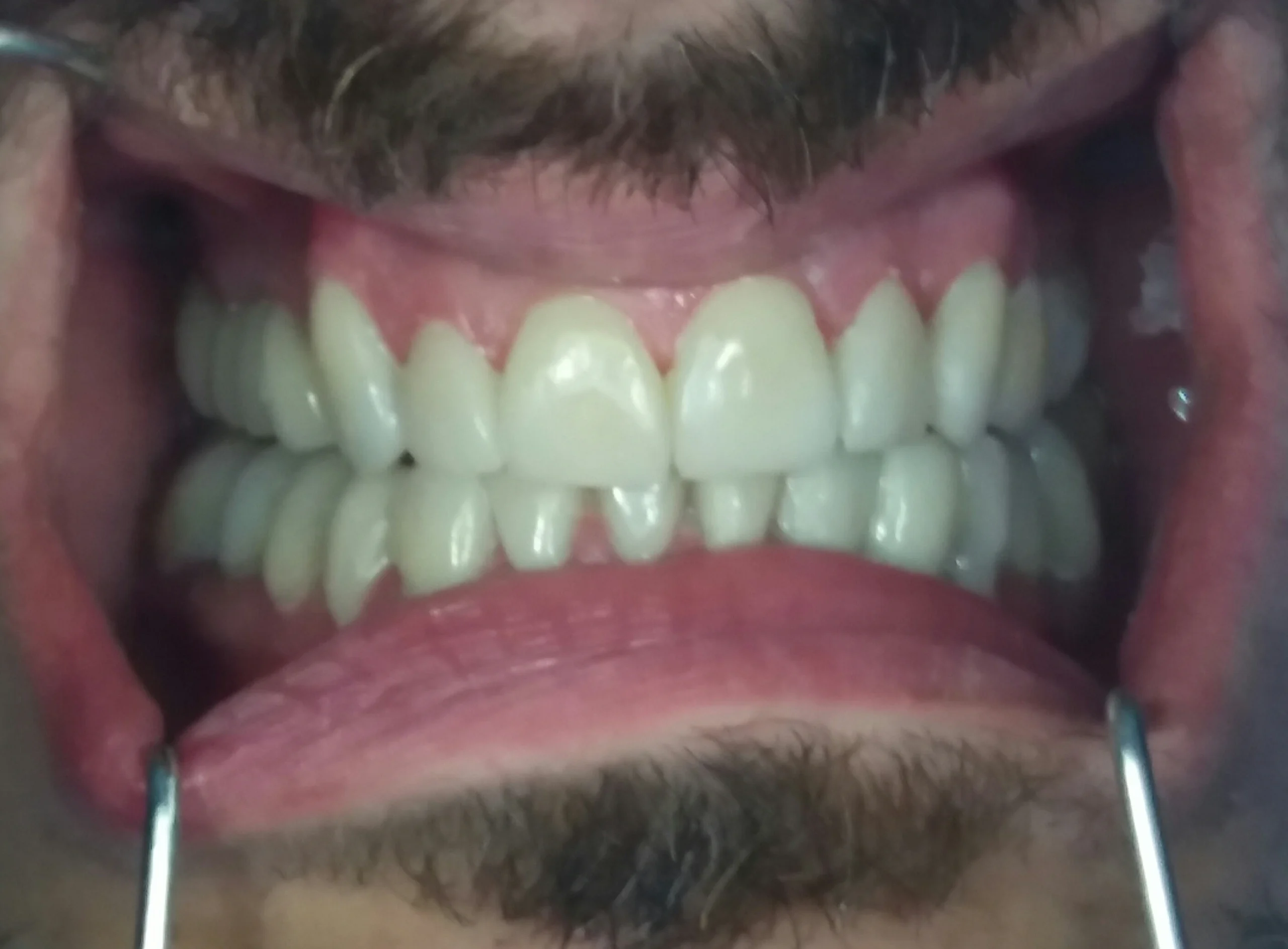 Facetas 3 Facetas 3